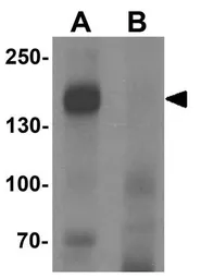 Anti-LNPEP antibody used in Western Blot (WB). GTX32096
