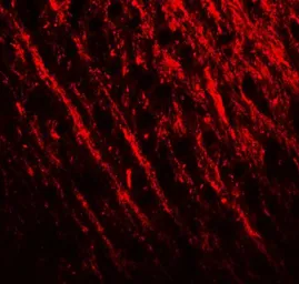 Anti-PRRT2 antibody used in IHC (Paraffin sections) (IHC-P). GTX32116