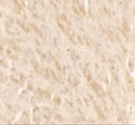 Anti-TLX2 antibody used in IHC (Paraffin sections) (IHC-P). GTX32117