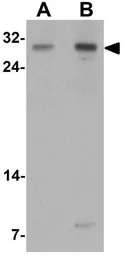 Anti-TLX2 antibody used in Western Blot (WB). GTX32117