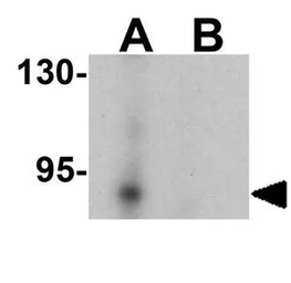 Anti-LSD2 / AOF1 antibody used in Western Blot (WB). GTX32122