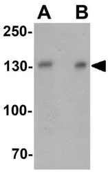 Anti-PPFIA3 antibody used in Western Blot (WB). GTX32124