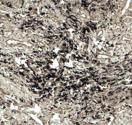Anti-Beclin 2 antibody used in IHC (Paraffin sections) (IHC-P). GTX32141