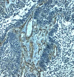 Anti-PALMD antibody used in IHC (Paraffin sections) (IHC-P). GTX32160