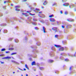 Anti-CREB (phospho Ser121) antibody used in IHC (Paraffin sections) (IHC-P). GTX32165