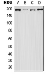 Anti-EGFR (phospho Ser1047) antibody used in Western Blot (WB). GTX32174
