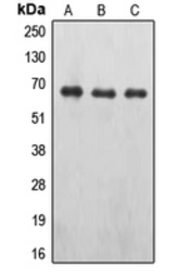 Anti-EPO receptor (phospho Tyr426) antibody used in Western Blot (WB). GTX32177