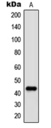 Anti-c-Jun (phospho Thr91) antibody used in Western Blot (WB). GTX32204