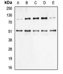 Anti-NFkB p105/p50 (phospho Ser337) antibody used in Western Blot (WB). GTX32223