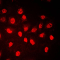 Anti-Rb (phospho Ser780) antibody used in Immunocytochemistry/ Immunofluorescence (ICC/IF). GTX32254