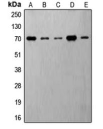 Anti-p70 S6K (phospho Thr421) antibody used in Western Blot (WB). GTX32259