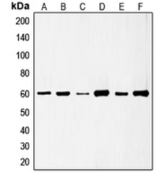 Anti-Src (phospho Ser75) antibody used in Western Blot (WB). GTX32263