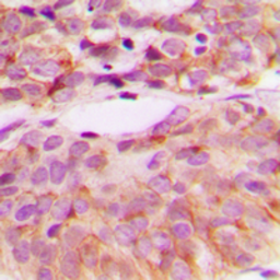 Anti-Src (phospho Tyr530) antibody used in IHC (Paraffin sections) (IHC-P). GTX32265