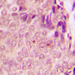 Anti-STAT3 (phospho Ser727) antibody used in IHC (Paraffin sections) (IHC-P). GTX32267