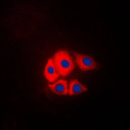 Anti-p130Cas (phospho Tyr249) antibody used in Immunocytochemistry/ Immunofluorescence (ICC/IF). GTX32286