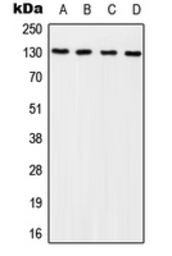 Anti-p130Cas (phospho Tyr249) antibody used in Western Blot (WB). GTX32286
