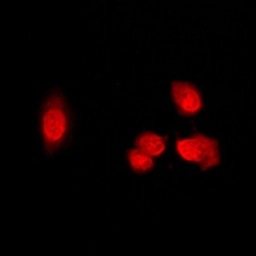 Anti-HDAC5 (phospho Ser498) antibody used in Immunocytochemistry/ Immunofluorescence (ICC/IF). GTX32287