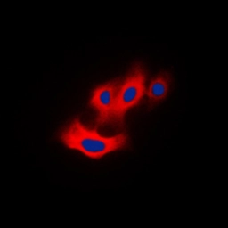 Anti-PAK4 (phospho Ser474) / PAK5 (phospho Ser602) / PAK6 (phospho Ser560) antibody used in Immunocytochemistry/ Immunofluorescence (ICC/IF). GTX32289