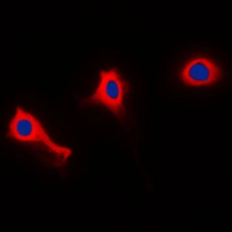 Anti-NCF1 (phospho Ser370) antibody used in Immunocytochemistry/ Immunofluorescence (ICC/IF). GTX32294