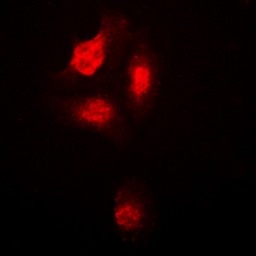 Anti-p38 MAPK (phospho Thr180) antibody used in Immunocytochemistry/ Immunofluorescence (ICC/IF). GTX32319