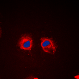 Anti-Cortactin (phospho Tyr466) antibody used in Immunocytochemistry/ Immunofluorescence (ICC/IF). GTX32326