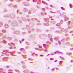 Anti-c-Jun (phospho Thr93) antibody used in IHC (Paraffin sections) (IHC-P). GTX32331