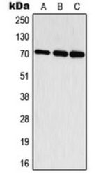 Anti-p70 S6K (phospho Thr444) antibody used in Western Blot (WB). GTX32353