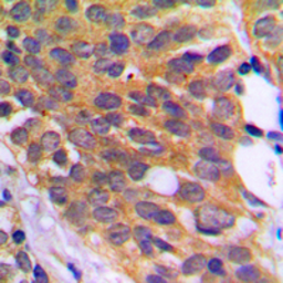 Anti-eEF2K (phospho Ser366) antibody used in IHC (Paraffin sections) (IHC-P). GTX32365