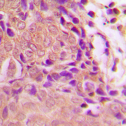 Anti-CDKN2A / p16INK4a (phospho Ser326) antibody used in IHC (Paraffin sections) (IHC-P). GTX32378