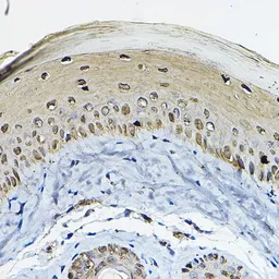 Anti-14-3-3 sigma antibody used in IHC (Paraffin sections) (IHC-P). GTX32418