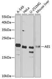 Anti-AES antibody used in Western Blot (WB). GTX32426