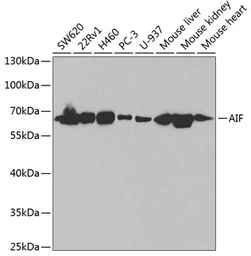 Anti-AIF antibody used in Western Blot (WB). GTX32428