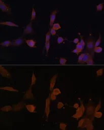 Anti-AMPK beta 2 antibody used in Immunocytochemistry/ Immunofluorescence (ICC/IF). GTX32439