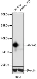 Anti-Annexin A1 antibody used in Western Blot (WB). GTX32444