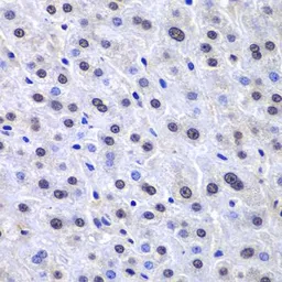 Anti-APE1 antibody used in IHC (Paraffin sections) (IHC-P). GTX32451