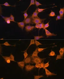 Anti-Bax antibody used in Immunocytochemistry/ Immunofluorescence (ICC/IF). GTX32465