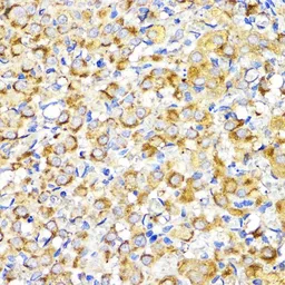 Anti-BMPR1B antibody used in IHC (Paraffin sections) (IHC-P). GTX32474