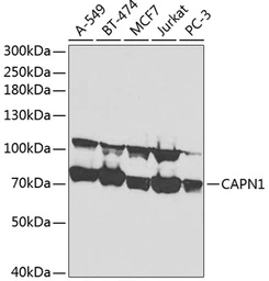 Anti-Calpain 1 antibody used in Western Blot (WB). GTX32486