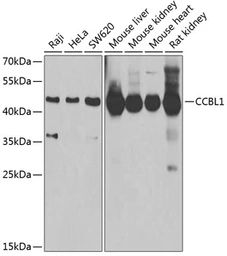 Anti-CCBL1 antibody used in Western Blot (WB). GTX32492