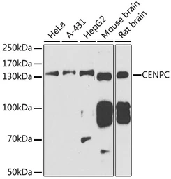 Anti-CENPC antibody used in Western Blot (WB). GTX32516