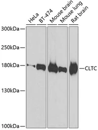 Anti-Clathrin Heavy chain antibody used in Western Blot (WB). GTX32526