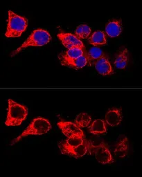 Anti-Cytokeratin 17 antibody used in Immunocytochemistry/ Immunofluorescence (ICC/IF). GTX32548
