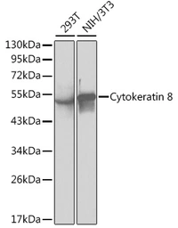 Anti-Cytokeratin 8 antibody used in Western Blot (WB). GTX32549