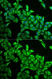 Anti-DAP1 antibody used in Immunocytochemistry/ Immunofluorescence (ICC/IF). GTX32550