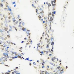 Anti-DBC1 antibody used in IHC (Paraffin sections) (IHC-P). GTX32552
