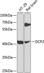 Anti-DCP2 antibody used in Western Blot (WB). GTX32554