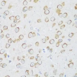 Anti-DHODH antibody used in IHC (Paraffin sections) (IHC-P). GTX32560