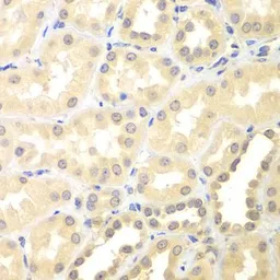 Anti-DTX2 antibody used in IHC (Paraffin sections) (IHC-P). GTX32566