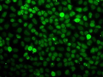 Anti-Exportin 5 antibody used in Immunocytochemistry/ Immunofluorescence (ICC/IF). GTX32594