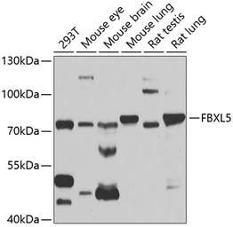 Anti-FBXL5 antibody used in Western Blot (WB). GTX32599